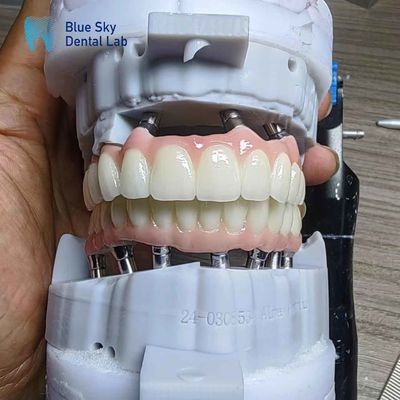 comprar Implante de zircônio em camadas Customização Casos de implantes de arco completo online manufacture