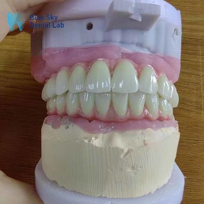 comprar Compatibilidade Universal Ponte Malo de Metal com Estrutura de Titânio Pura online manufacture