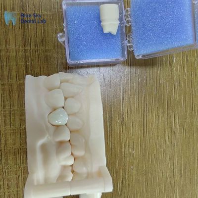 comprar Estética Restaurações dentárias de zircônio Coroas de porcelana de zircônio online manufacture