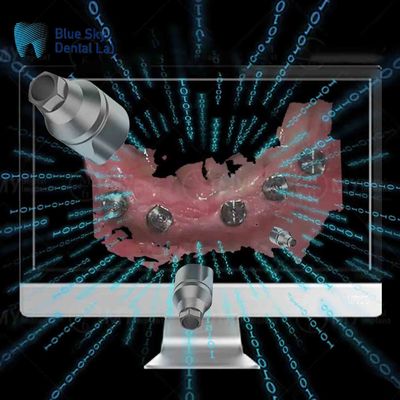 comprar Implante reutilizável corpo de varredura direta todos em um corpo de varredura dentária online manufacture