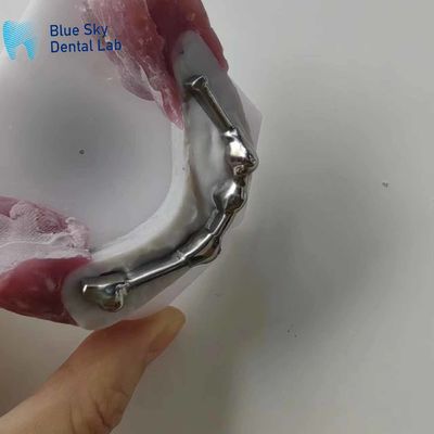 comprar Barras de titânio dentárias personalizáveis com dentes de abutment para próteses dentárias online manufacture