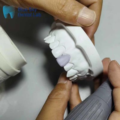 comprar 0.3mm Finos Implantes Cerâmicos de Vidro online manufacture