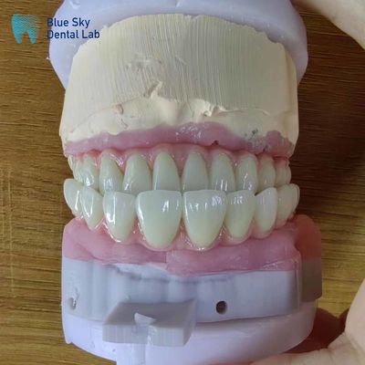 comprar Implantes dentários artificiais de arco completo Casos de operação para procedimentos cirúrgicos online manufacture