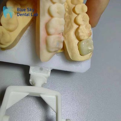 comprar Coroas de zircônio resistentes à corrosão de aparência natural Dentes de zircônio online manufacture