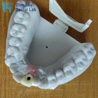 comprar Esterilização a vapor Coroa de implante único Coroa de implante dentário de superfície lisa online manufacture
