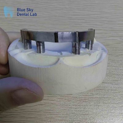 comprar Barras de titânio dentário de precisão Barras de titânio polidas para implantes dentários online manufacture