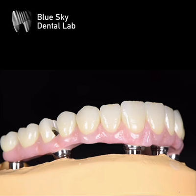 comprar Blue Sky Nature Implantação Dental Caso Implantação Sistema de Múltiplas Opções online manufacture