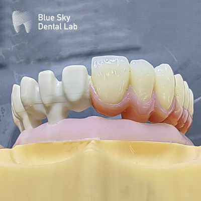 comprar Customize Casos de Implante de Cor com Design Natural de Superfície Suave para Compatibilidade Universal online manufacture