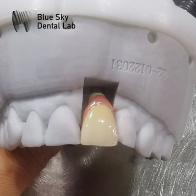 comprar Casos de implante regulares Compatibilidade universal Casos de implante dentário online manufacture