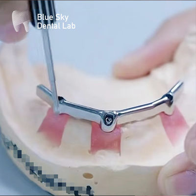 comprar Barras de titânio dentário de precisão com acessórios preciosos Biocompativeis online manufacture