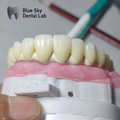 comprar Caixa de implante dental universal compatível com múltiplos sistemas de implantes online manufacture