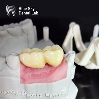 comprar Casos de implante de superfície lisa Esterilização a vapor Casos de implante dental online manufacture