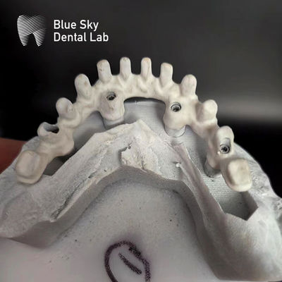comprar Implante de céu azul personalizável online manufacture