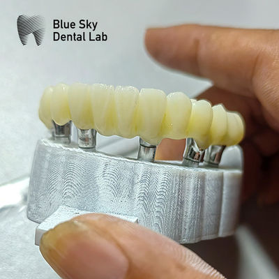 comprar Casos de implante de ponte PMMA para cenários de implantação de superfície lisa online manufacture
