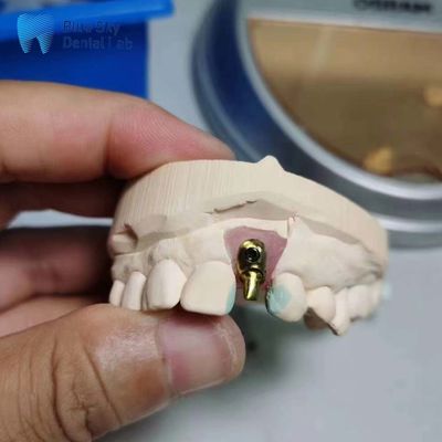 comprar Casos de implantes regulares Customizable Implante único Dente Offset Arco Implante Casos online manufacture