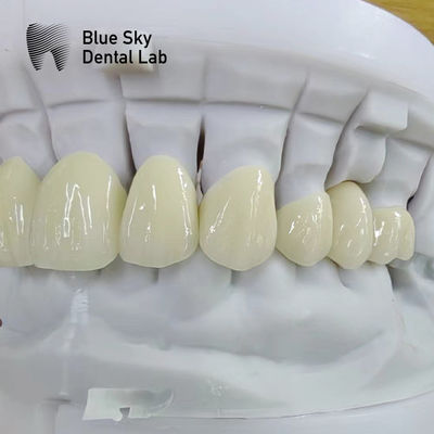comprar Coroa de zircônio translúcida em camadas Restauração dental Coroa de zircônio multicamadas online manufacture