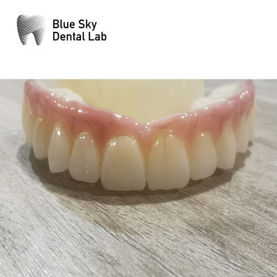 comprar Compatibilidade Caixas de implantes Caixas dentárias do sistema de implantes regulares online manufacture