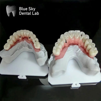 comprar Implantação de céu azul Casos de implantação de arco completo Casos de implantação de natureza online manufacture