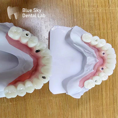 comprar Casos para implantes dentários múltiplos Casos para implantes personalizados online manufacture