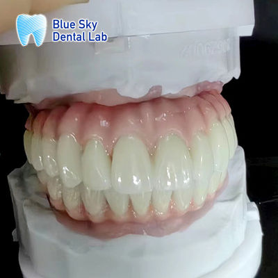 comprar Caso de Implante Dental Regular Natureza e Durabilidade para Equipamentos Médicos online manufacture