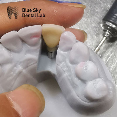 comprar Estudos de biocompatibilidade Cenários de implantação Esterilização a vapor online manufacture