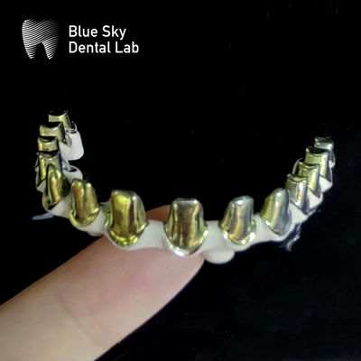 comprar Prata-Ouro Universal de Titânio puro Quadro Dental de Metal Personalizável online manufacture