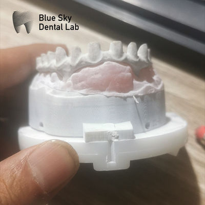 comprar Ponte de implante de malha industrial personalizável em prata e ouro online manufacture