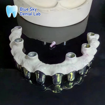 comprar Puro Titânio Ponte Malo Dentes de estrutura de metal de prata personalizáveis online manufacture