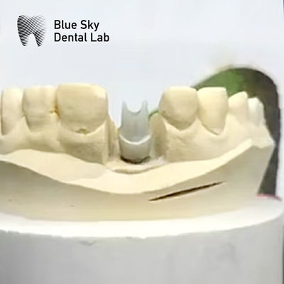 comprar Implante de abóbora de zircônio estético Biocompativel Precision Milled online manufacture