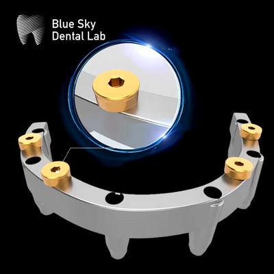comprar Dentadura de localizador removível Dentadura de implante de titânio superior online manufacture