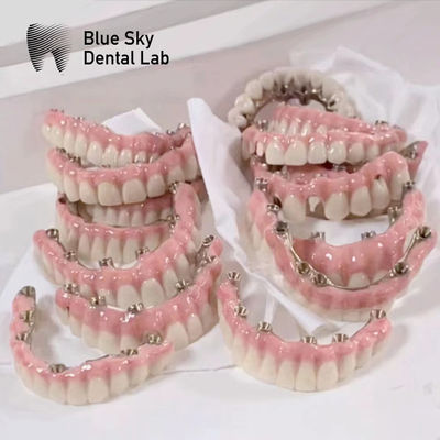 comprar Caixas de Implante Blue Sky com Ponte de Marco Malo Titânio puro online manufacture