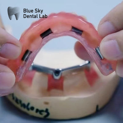 comprar Prótese dentária de titânio com adesivos de prata e ouro online manufacture