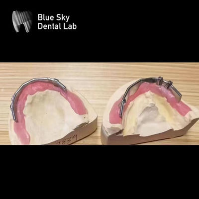 comprar Implantes Dentários Blue Sky Bar de Titânio Prateado Para Implantes Dentários online manufacture
