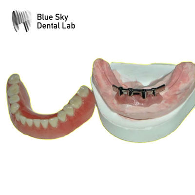comprar Barras de titânio removíveis para dentaduras online manufacture