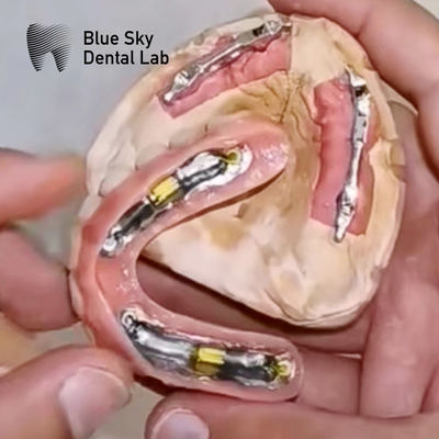 comprar Implantes dentais Blue Sky com barra de titânio para próteses removíveis online manufacture