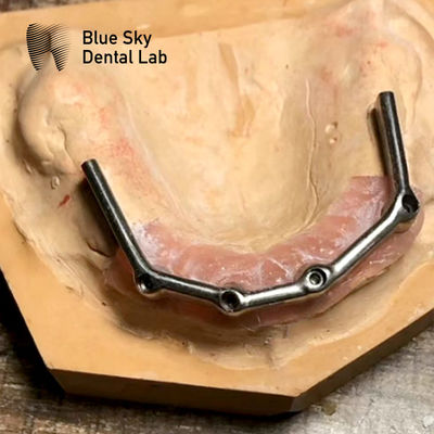 comprar Implante Dental de Titânio de Barra Superior Completa Restauração da Boca Implante de Céu Azul online manufacture