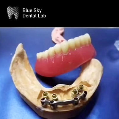 comprar Barras de titânio dentárias de boca inteira Restauração de dentadura removível precisa online manufacture