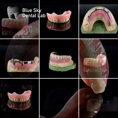 comprar Barras de Titânio Dental Universal Personalizadas Com Dentadura Acrílica online manufacture