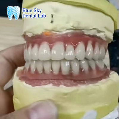 comprar Implantes Dentários de Titânio de Barra Superior e Inferior online manufacture