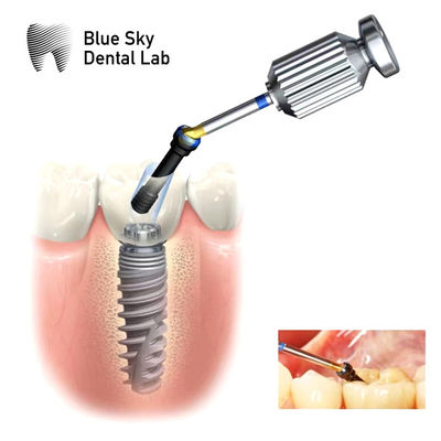 comprar Abutment ASC hexadecimal interno Abutment de canal de parafuso angulado ajustável online manufacture
