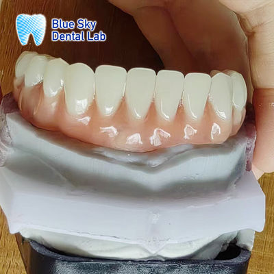 comprar Dentadura de resina acrílica de aparência natural online manufacture