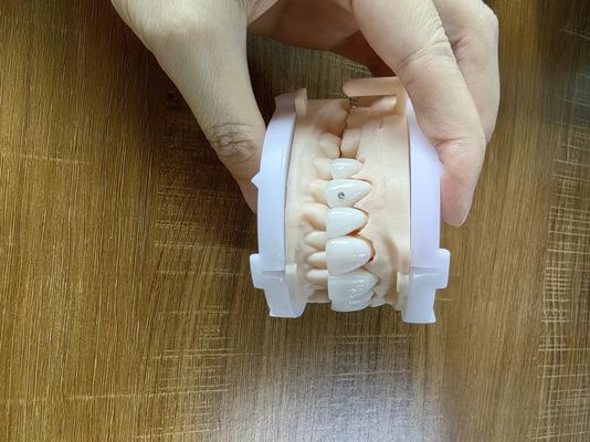 comprar Coroas de zircônio altamente translúcidas, fachadas de ponte com jóias personalizadas e ouro, bela caixa de restauração dentária. online manufacture