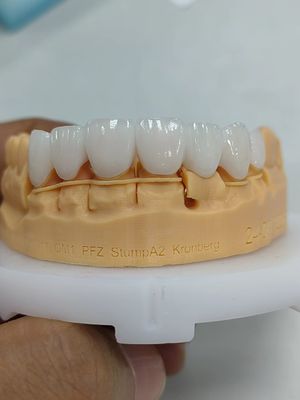 5 mm-6 mm Coroas de zircônio em camadas Força Coroa de zircônio multicamadas