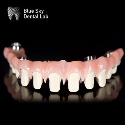Sistema de Implante Dental de Ponte Malo de Titânio Puro Blue Sky