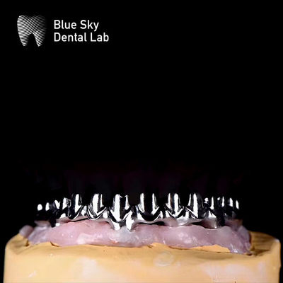 Puro Titânio Metal Quadro Dental Malo Pontes Para Prata E Ouro Cor Quadro