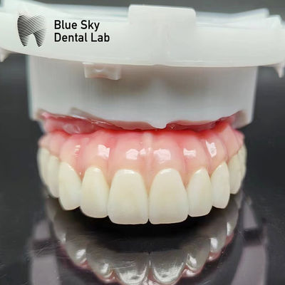 Caixas de Implante Dental Naturais Caixas de Implante de Boca Inteira Limpa Para Sistema de Implante
