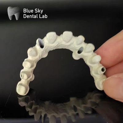 Estrutura de Titânio Ponte Malo Dental Ponte Implante de Malo Personalizado