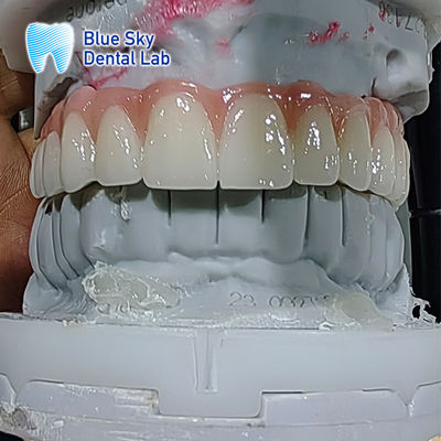 Implantação Dental Artificial Esterilização Múltipla