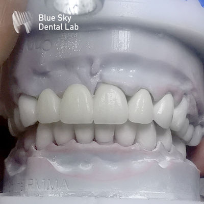 Dentes de zircônio retangulares em camadas de camada múltipla antes do vidrado