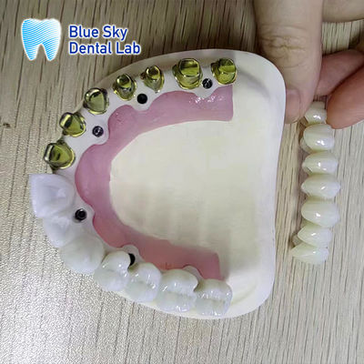 Quadro de metal de titânio puro de prata-ouro Dental Quadro de metal revestido de ouro parcial